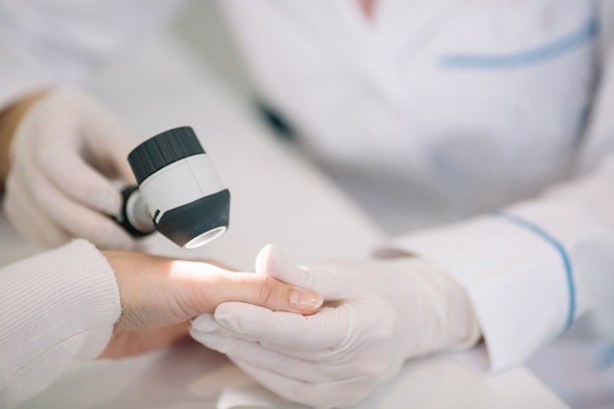 Consult Your Dermatologist for Proper Assessment