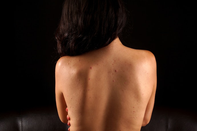 Consult a Board-Certified Dermatologist and Practice Smart Prevention