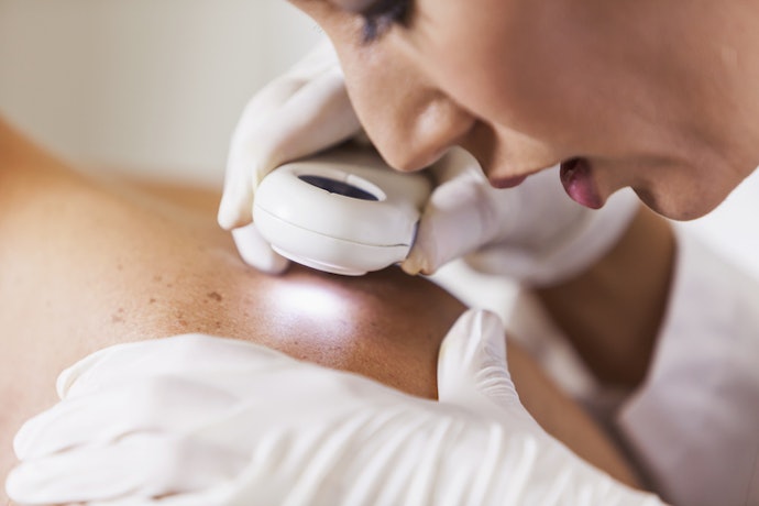 When OTC Creams Fail, Consult a Board-Certified Dermatologist