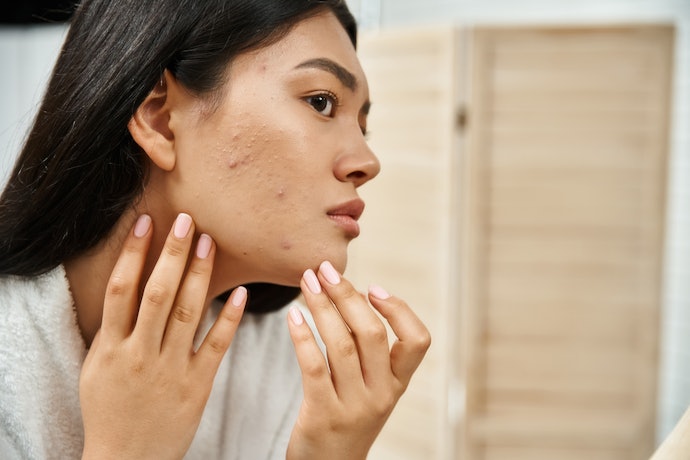 What Is a Salicylic Acid Cleanser and How Does It Work?