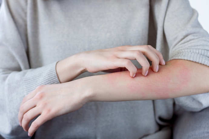 Know the Most Common Causes of Itchy Rashes