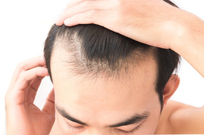 How Does Saw Palmetto Support Prostate and Hair Health?