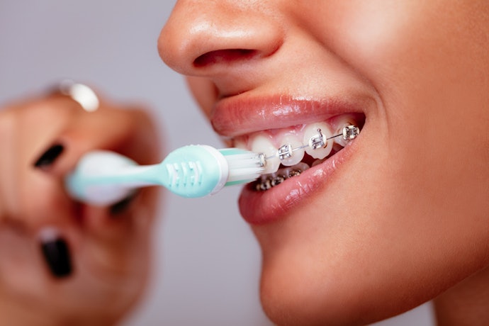 Can You Use a Normal Toothbrush for Braces?