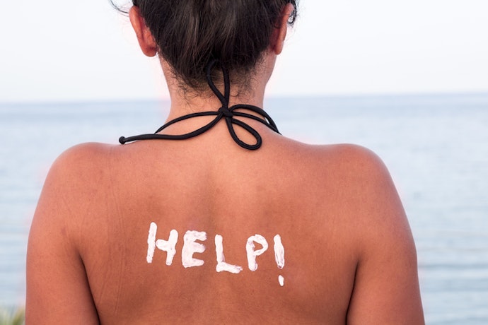 Is Sunburn Permanent or Does It Fully Heal?