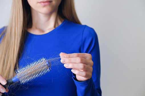 What Are the Common Causes of Hair Fall?