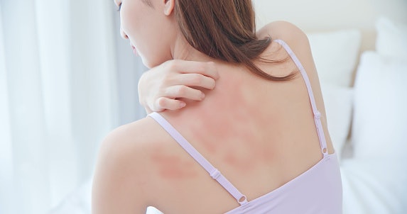 What's the Difference Between Sensitive Skin and Reactive/Allergy-Prone Skin?