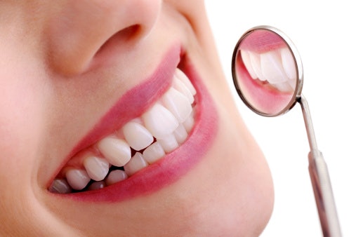 How Do Teeth Whiteners Work?
