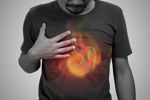 What’s the Difference Between Hyperacidity, Heartburn, and GERD?