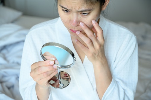 Amino Acids Are Vital for Damaged Skin