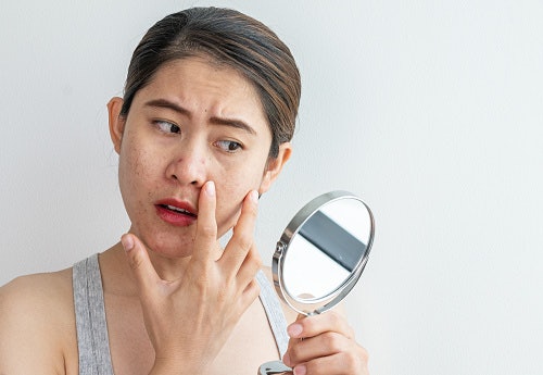 Consider Pore-Refining Cleansers if You Have Oily Skin