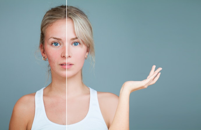 Avoid Harsh Ingredients, Especially if You Have Sensitive Skin