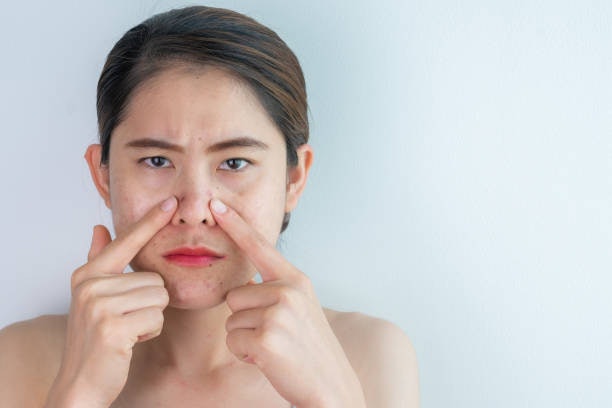 UV Rays and Environmental Stressors