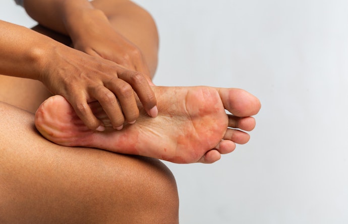 Avoid Steroids and Sulfur for Safer Fungal Treatment
