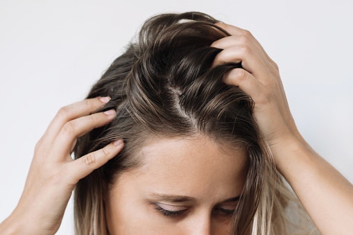 Avoid Harsh Ingredients Like Sulfates and Parabens if You Have a Sensitive Scalp