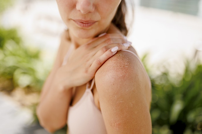 Avoid Alcohol, Fragrance, Menthol, and Petroleum-Based Ingredients