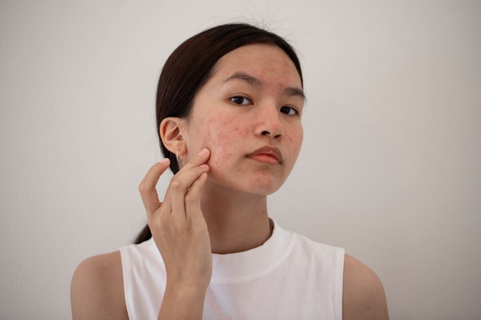 Spot Treatments Have Higher Concentration of Active Ingredients