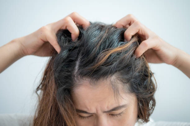 Avoid Irritating Ingredients if You Have a Sensitive Scalp