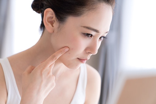 Steer Clear of Fragrance, Alcohol, and Harsh Essential Oils That Can Worsen Acne