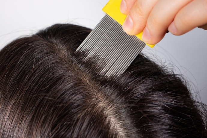 Pair Shampoos, Lotions, and Fine-Tooth Combs for Complete Lice Removal