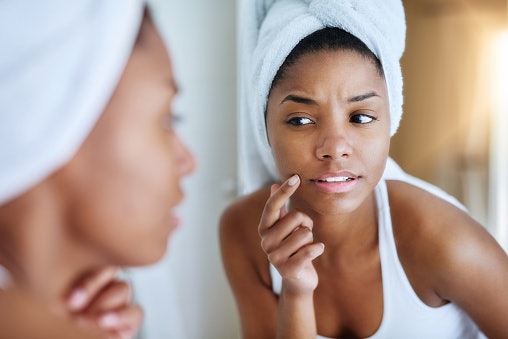 Steer Clear From Synthetic Fragrances and Alcohol, and Go for a Non-comedogenic Micellar Water to Avoid Irritation and Breakouts