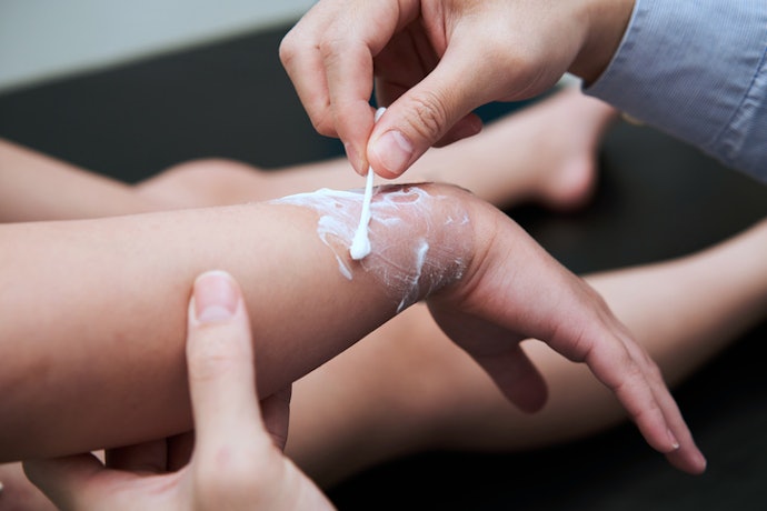 Confirm That the Product Is Intended for Minor Burns or Wound Care