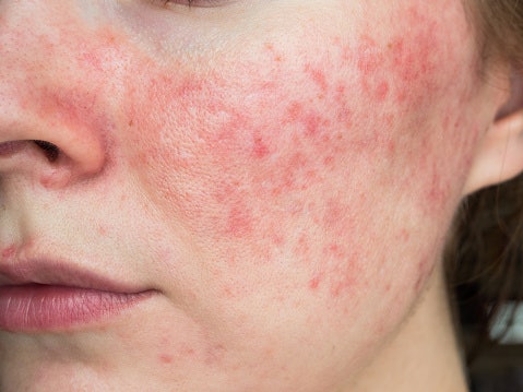 Avoid Harsh Ingredients, Especially if You Have Sensitive Skin