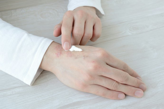 Choose FDA-Approved Products for Reliable and Safe Treatment