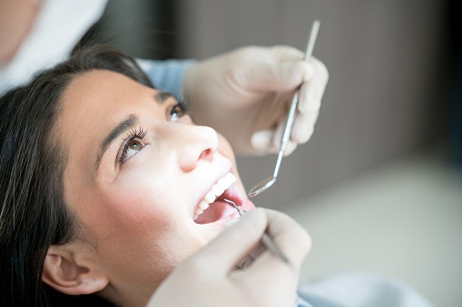 Look Back at Your Dental History to Avoid Color Differences