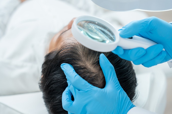 Prioritize Proven Ingredients That Reduce Hair Fall