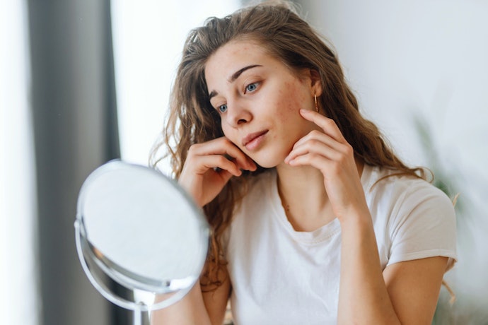 Acne-Fighting Ingredients Like Niacinamide to Reduce Breakouts