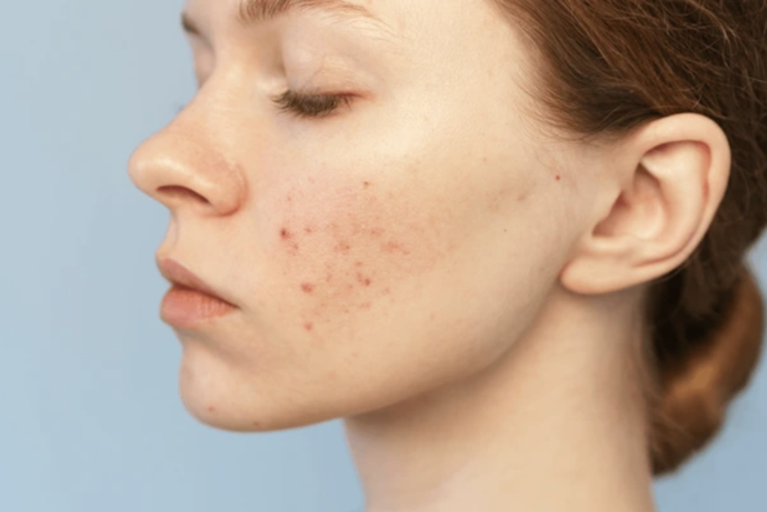 For Dark Spots or Uneven Tone: Even Out Skin With Niacinamide and Vitamin C