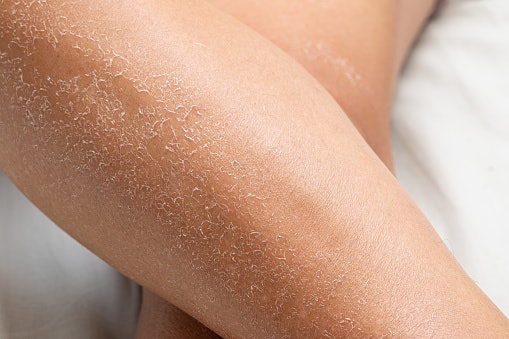 For Very Dry or Flaky Skin: Look for Rich, Occlusives Like Shea or Cocoa Butter