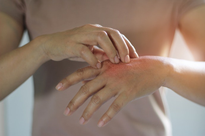 To Relieve Dryness and Prevent Scaling: Moisturizing Agents Like Petrolatum, Ceramides, and Glycerin