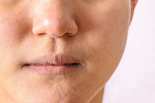 For Dryness and Texture: Ceramides, Squalane, and Panthenol Deeply Moisturize and Smoothen