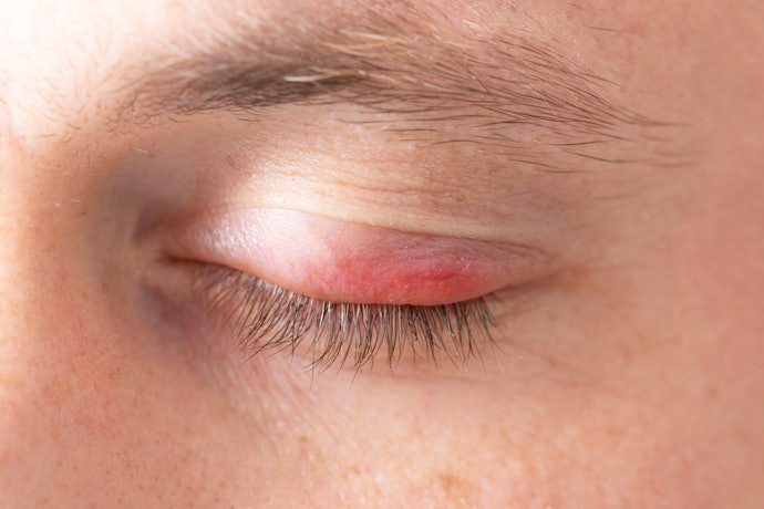 For Redness and Puffiness: Eye Drops with Decongestants Offer Fast Relief