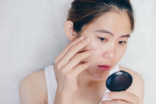 For Oiliness and Breakouts: Control Sebum with Niacinamide and Salicylic Acid