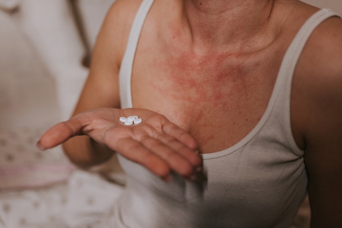 For Chronic or Widespread Eczema: Take Oral Medications Such as Antihistamines or Corticosteroids