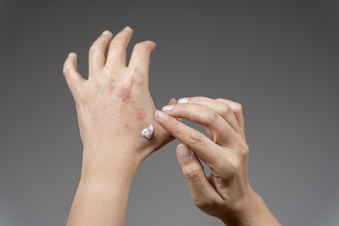 Look for Antiseptic or Antimicrobial Components to Prevent Infection