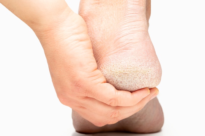 For Dry and Cracked Skin: Pick Moisturizing Foot Masks With Shea Butter