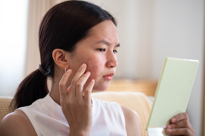 Cream/Pot Concealers: Ideal for Stubborn Acne Marks
