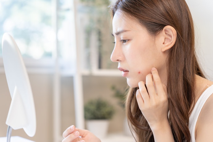 Acne Marks and Uneven Texture: Go for Glycolic Acid