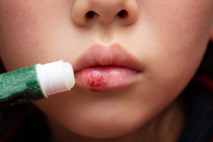 Avoid Strong Actives, Fragrances, and Essential Oils That May Cause Irritation