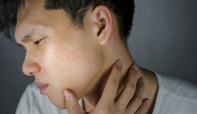 For Oily Skin: Choose Oil-Free, Lightweight Gels With Niacinamide