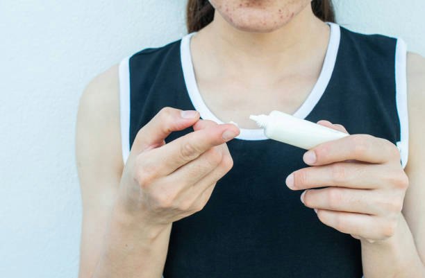 For Fading Discoloration: Niacinamide and Vitamin C