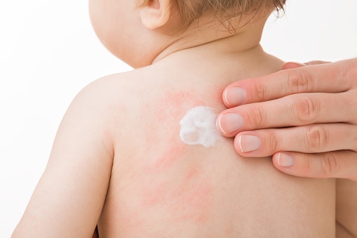 For Barrier Support: Choose Niacinamide and Panthenol