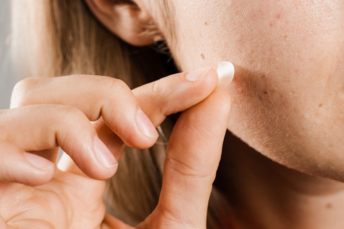 Non-medicated Patches for Superficial Acne