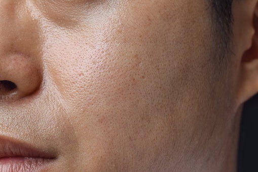 For Oily or Combination Mature Skin: Select Lightweight, Gel-Type or Water-Based Lotions