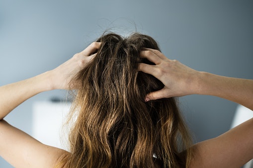 For Oily or Itchy Scalps: Choose Shampoos With Mild Degreasing Agents