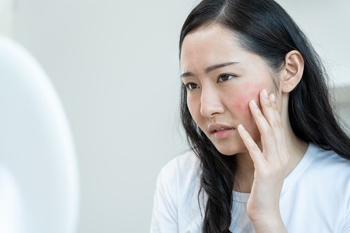 Combine Soothing Ingredients with Rosehip Oil for Sensitive Skin