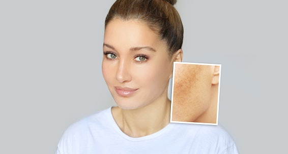 For Dark Spots and Hyperpigmentation: Look for Niacinamide, Kojic Acid, Alpha Arbutin, or Tranexamic Acid